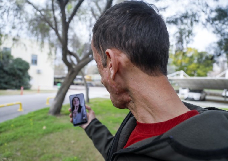 Türkiyenin ilk yüz nakli ona yapılmıştı... Donörün kızı ile duygulandıran görüşme: Babamın yüzü Uğurda yaşıyor