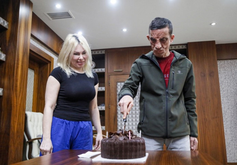 Türkiyenin ilk yüz nakli ona yapılmıştı... Donörün kızı ile duygulandıran görüşme: Babamın yüzü Uğurda yaşıyor