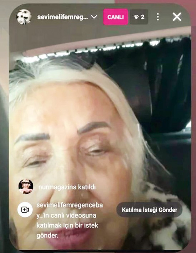 Fotoğraflarımda filtre yok demişti, kendini ele verdi