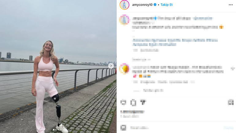 Kanser annesi, dedesi, anneannesi ve babaannesini aldı, henüz 13ündeyken de onu buldu… Doktorlar yüzde 50 yaşama şansı verse de o tek bacağıyla yıldız bir sporcu oldu