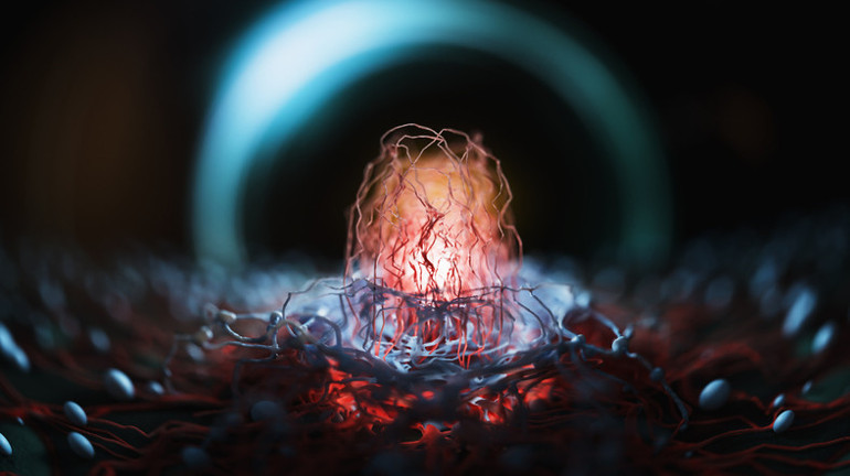 Diyabet sandılar, pankreas kanserinden hayatını kaybetti | Karın ağrısı, hazımsızlık, şişkinlik kanserin habercisi olabilir