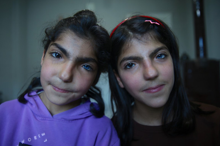 Göz renklerini görenler şaşırıyor