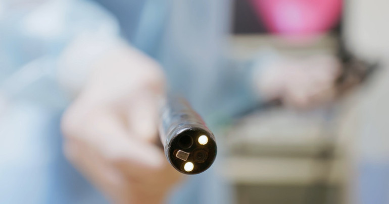 Endoskopi riskli bir işlem mi Bağırsak veya midede oluşan delinmeyi erkenden fark etmek hayati önem taşıyor