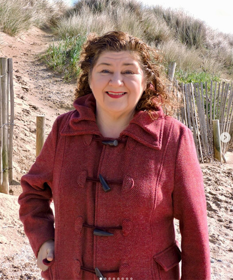 Yılların oyuncusu diziden ayrıldı, hayatı drama döndü: Artık restoranlarda şarkı söylüyor... Karnını bile zor doyuruyor