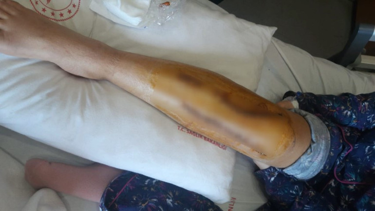 İstanbuldan Şanlıurfaya giden avukat dehşeti yaşadı Ağır yaralandı, 3 ameliyat geçirdi... Başka avukatı da 3 yerinden bıçaklamış