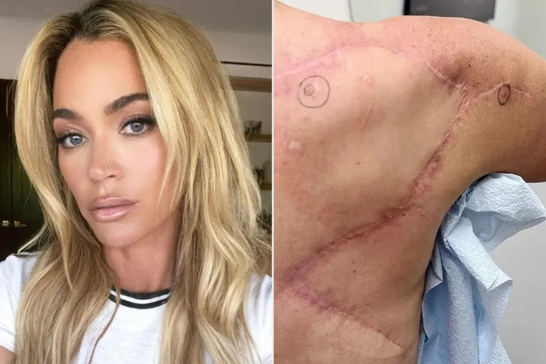 Önce kanser oldu sonra beyninde tümör bulundu… Gözündeki yaş dinmiyor… İyileşmeyi beklerken kötü haber aldı