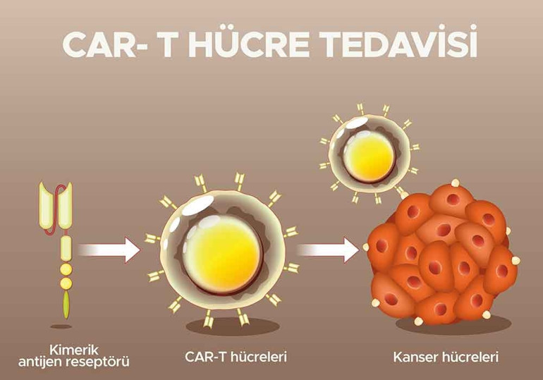 Sağlık Bakanı müjdeyi verdi Yerli CAR-T tedavisi kanser hastalarına umut olacak... Kemoterapi ve akıllı ilaçlar tarih mi oluyor