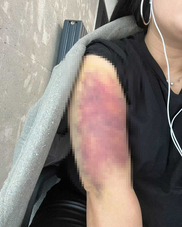 Eski sevgilisi hayatını kararttı Yaşadığı dehşetti anlattı: Böyle video çekeceğim aklıma gelmezdi