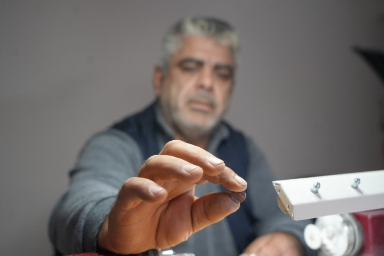 Gramı altın kadar değerli | Ağaçlardan sızıyor, birer şahesere dönüşüyor... Doktor tavsiyesiyle gelip alan oldu