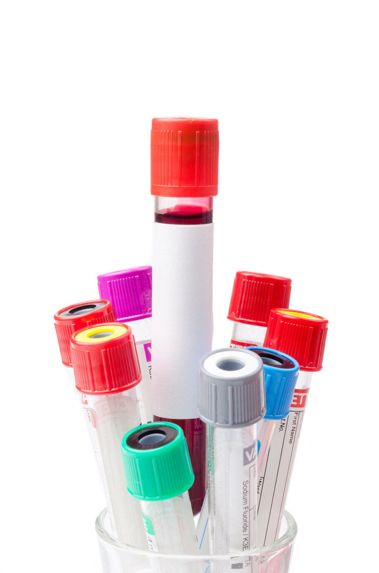 Uzun yaşayanların kanında ne var Kaderimiz tamamen genlerimize mi bağlı