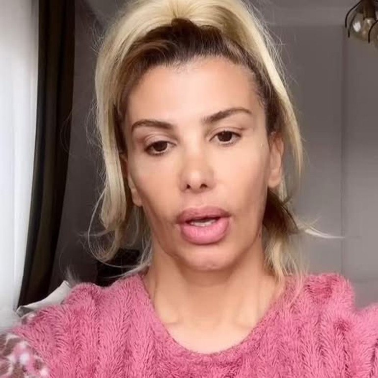 Botoks yüzünden zehirlenmişti... Ünlü şarkıcı yaşadığı zor günleri anlattı