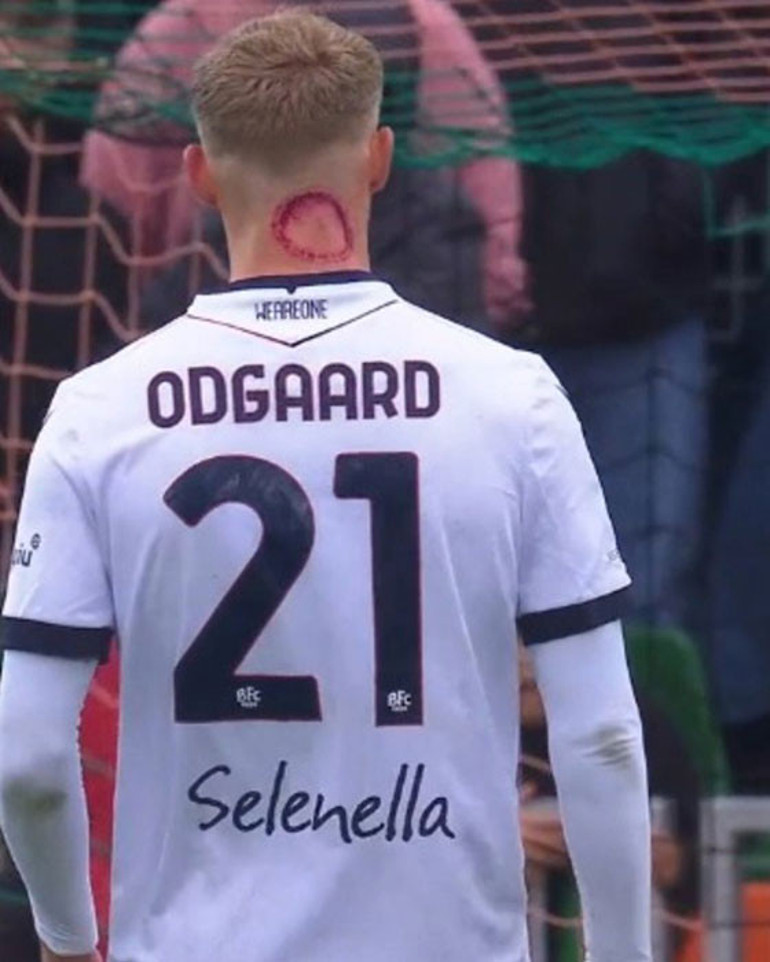 Korkutan görüntü Serie A oyuncusunun dikkat çeken görüntüsü