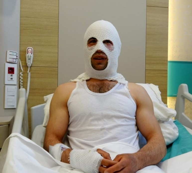Tek amacı nişanlısını mutlu etmekti... Bir anda dehşeti yaşadı: Hastanelik oldu, evi hasar gördü