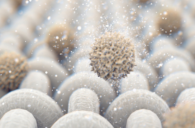 Satın aldığı kıyafeti giydi ve hayatı altüst oldu Sakın bunu yapmayın O kıyafetler mikrop içinde yüzüyor”