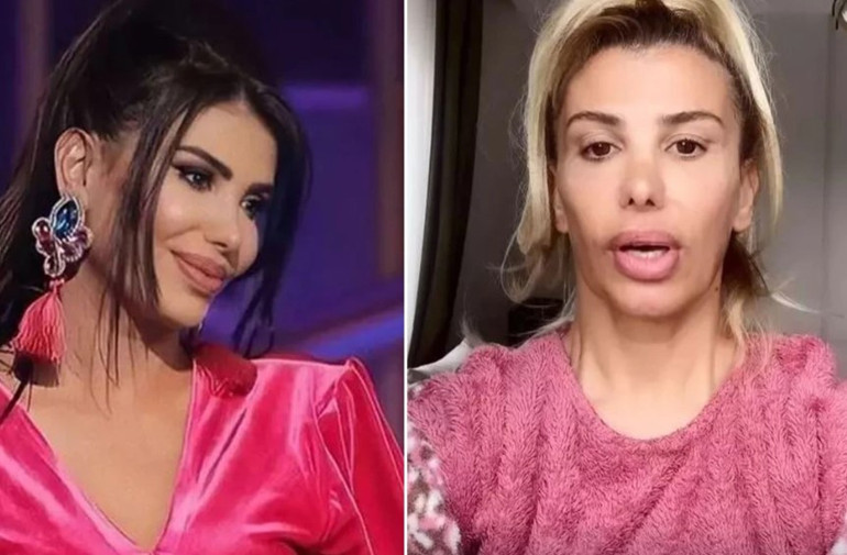 Şarkıcı Hatice: Ramiz resim çerçevesini kafamda kırdı