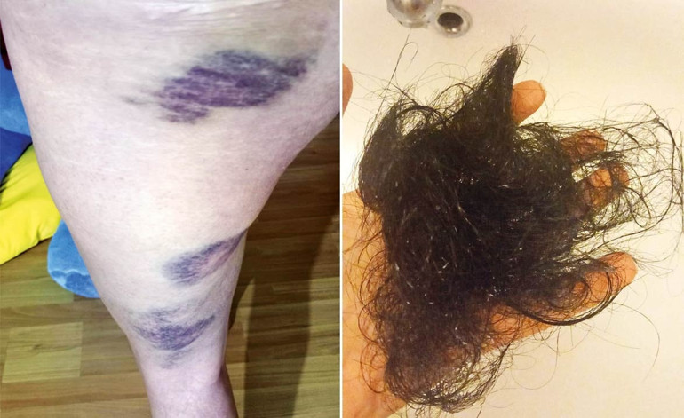Sabiha’nın şiddet kabusu... Çocuğu olmuyor diye darp edildi