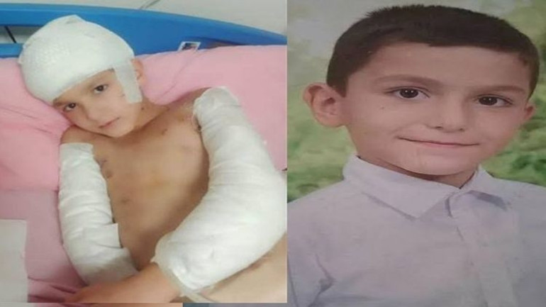 Sokak köpeklerin saldırdığı Tunahanın davasında flaş gelişme