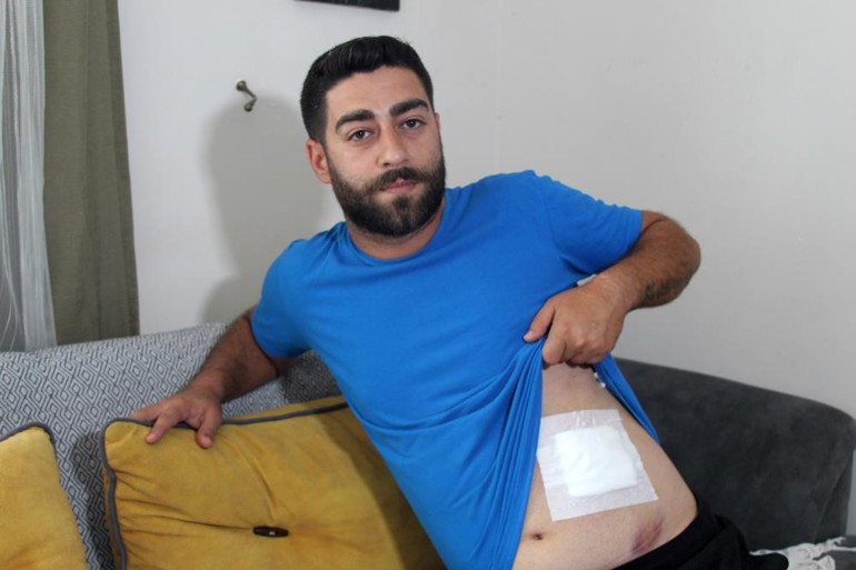 Karnında hissettiği ağrıyla hastaneye gitti, gerçek çekilen röntgenle ortaya çıktı