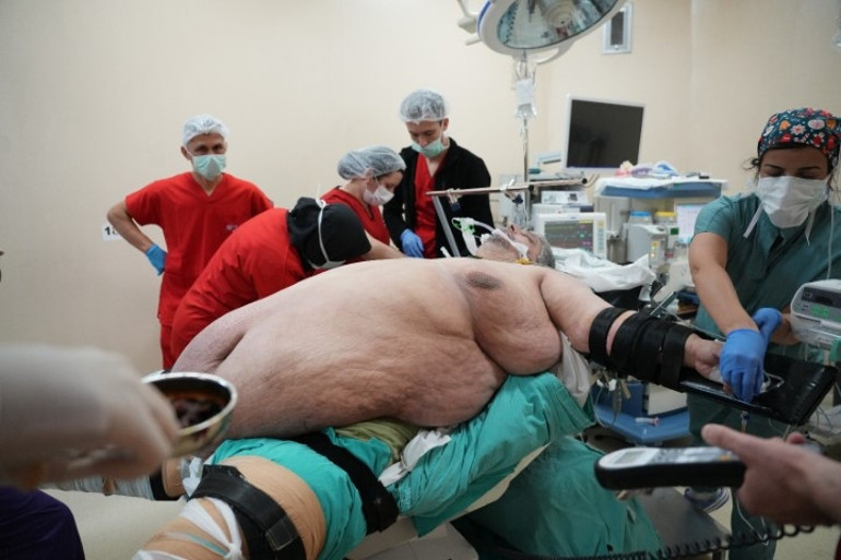 310 kiloya ulaşan adamın dramı son buluyor Duyduğu cümle hayatını değiştirdi | Yeri geldi ölmek için dua ettim