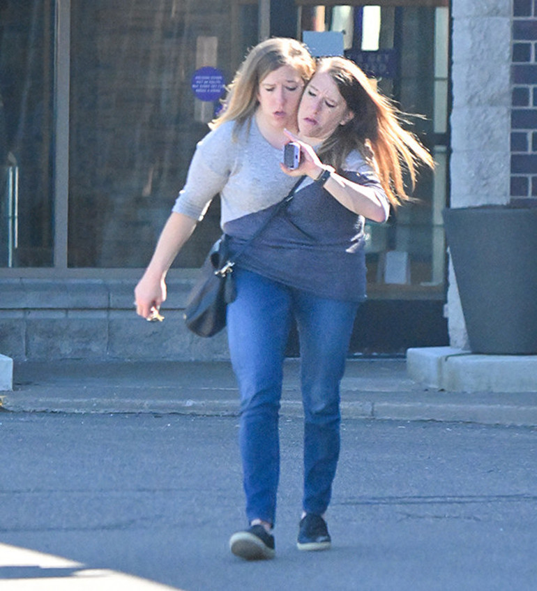 Doktorlar ‘Yaşamaları imkansız’ demişti… 35 yaşındaki yapışık ikizlerin çocuğu oldu