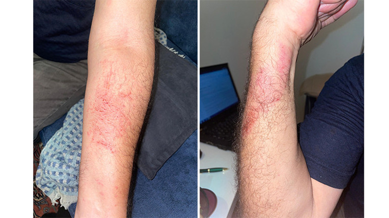Saldırıya uğradı ölümden döndü: Saldırgan tutuksuz yargılanacak