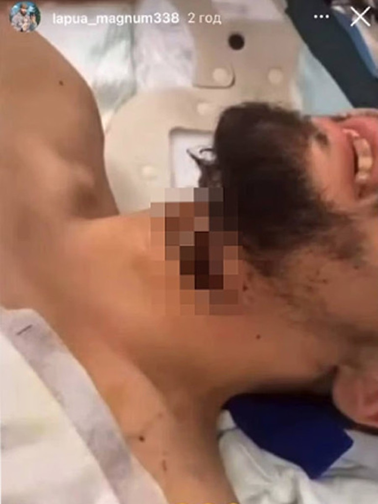 Toplu mezardan kaçış: Boğazı kesilerek gömüldü... Tırnaklarıyla toprağı kazıp çıktı Ukraynalı askerin hayatta kalma mücadelesi