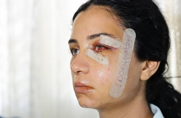 Anneye imdat mesajı: Öldürdü bu beni | Önce kabusu yaşattı sonra hastaneye götürdü... Gözü dönmüş eski eş serbest kaldı