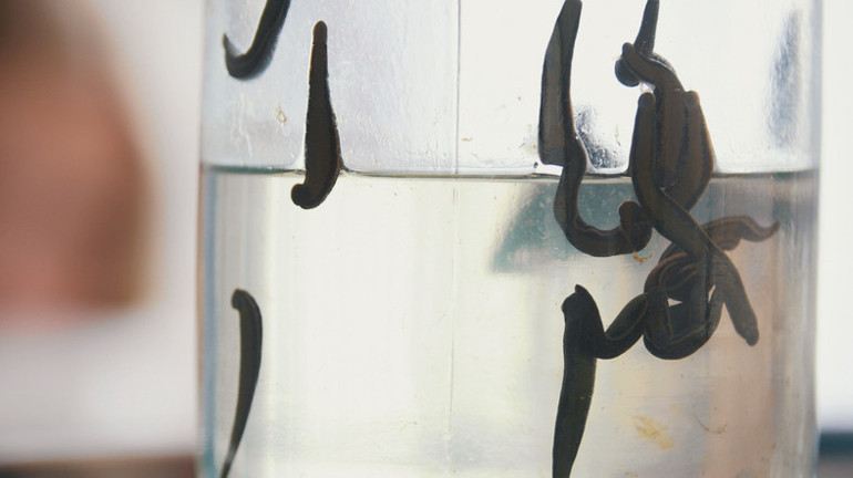 2500 yıllık gelenek can alıyor Enfeksiyon tüm vücudunu sardı, 7 ameliyatla hayata döndü Uzmanlardan kritik 10 uyarı