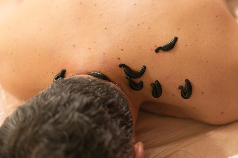 2500 yıllık gelenek can alıyor Enfeksiyon tüm vücudunu sardı, 7 ameliyatla hayata döndü Uzmanlardan kritik 10 uyarı