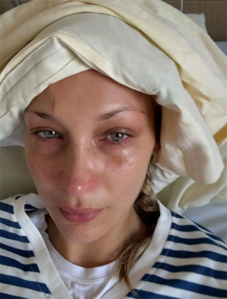 Güzelliği ve milyonları olsa neye yarar... Sağlığı çoktan gitti... Bir hastane odasında çaresiz hastalığıyla baş başa