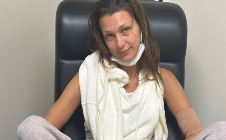 Bella Hadidin hastalığı nedir, bulaşıcı mı Lyme hastalığı belirtileri nelerdir, neden olur, tedavisi nasıl yapılıyor