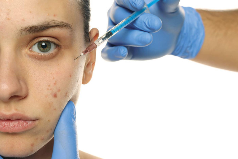 Sivilceye karşı iki aşı yolda