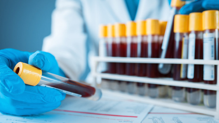 Alzheimer tedavisinde yeni ufuklar-2 Diyabet ilaçları umut veriyor