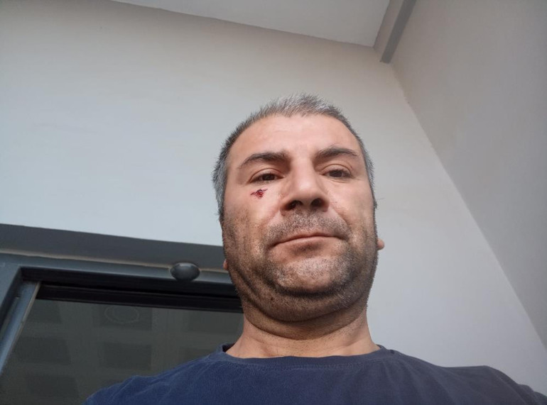 Adana Sarıçam'da camide darp edilen kişi
