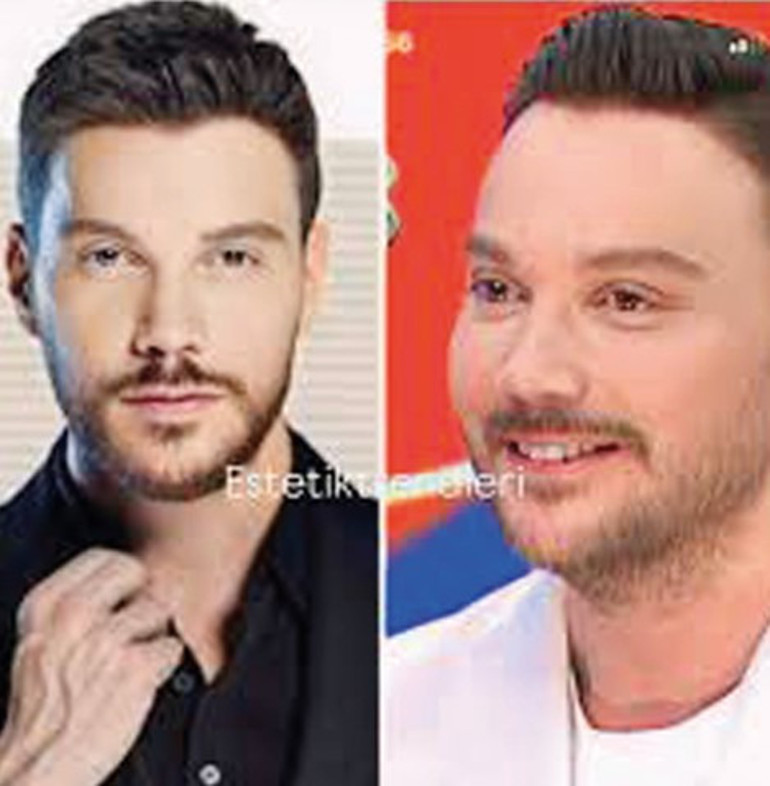 Diziler, antikanın lokomotifi olmuş