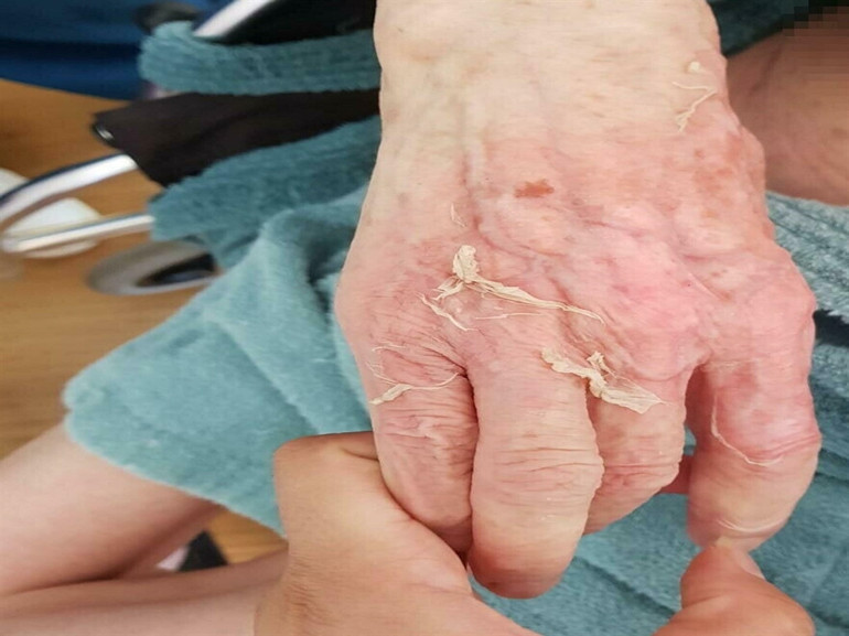 Huzurevinde banyo sonrası ölüm Doktor hakkında yakalama kararı çıktı