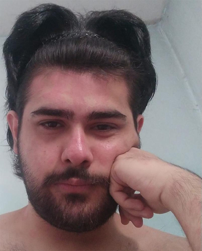 3 yıldır evden dışarı çıkmıyor, tırnaklarını kesmiyordu Eski hali ortaya çıktı | Arkadaşı Barışın değişimini anlattı