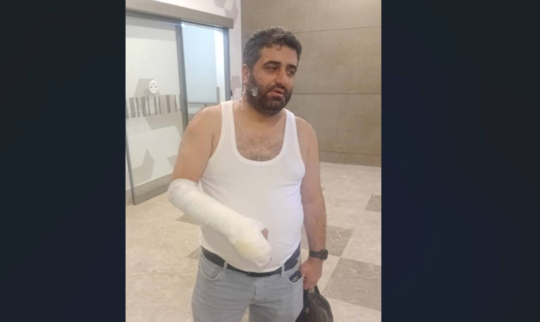 Patlama sonrası araç ve çevresinde hasar izleri