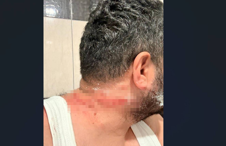 Olay yerinden geniş açı görüntü