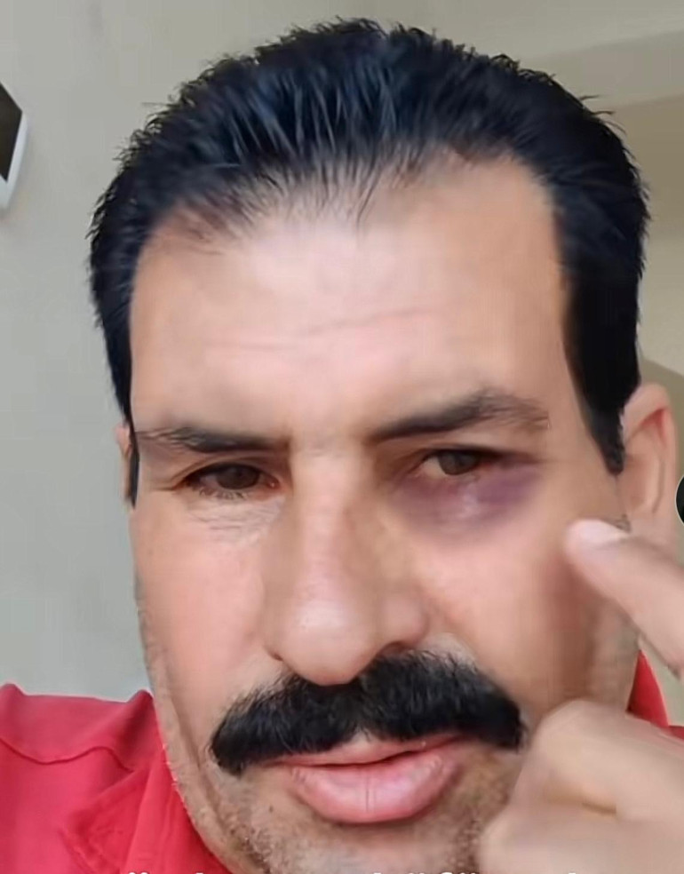 Canlı yayın sonrası evine gelen grup tarafından dövüldü | Rojin Kabaişe hakaret eden şahıs tutuklandı