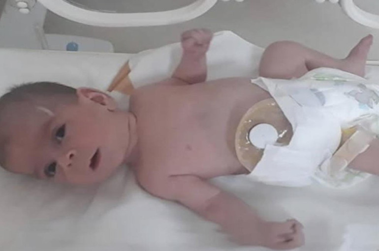 Kızlarının hemşire şiddeti sonucu engelli kaldığını dava açılınca öğrendiler