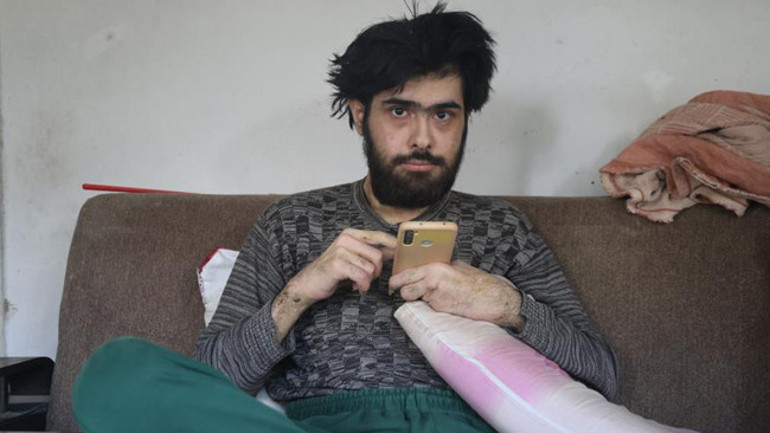 3 yıl sonra duş alıp dışarı çıkan Barışa teşhis kondu: Tedaviye başlandı | Barışı sosyal hayata ailesine kazandırmaya çalışacağız