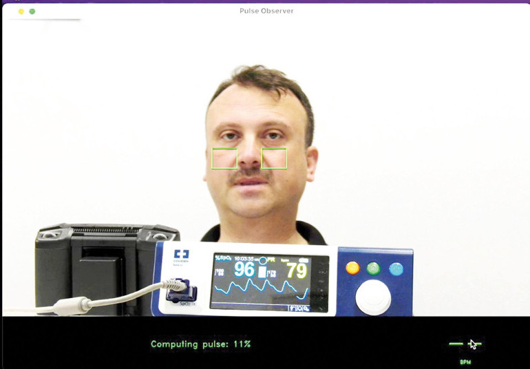 Türk doktor icat etti dünya hayran kaldı... Olay yerinde dronlu tetkik