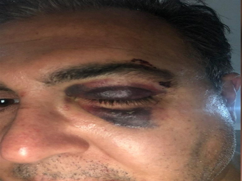 Yeşilköy sokakta gerçekleşen saldırı anından görüntü