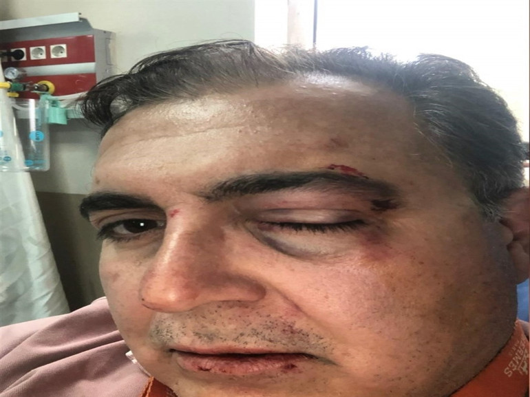 Güvenlik kamerası kayıtlarından saldırı anı