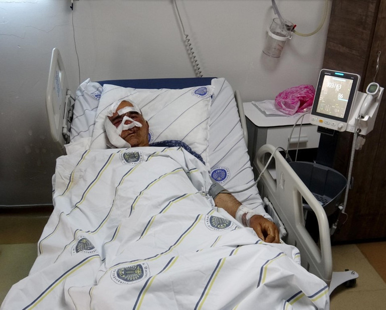 Köyde ayı saldırısı sonrası yüz yaralanması