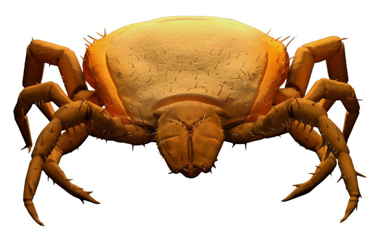 Hamburger yedikten saatler sonra vefat etti Bu şekilde ölen ilk kişi olarak tarihe geçti