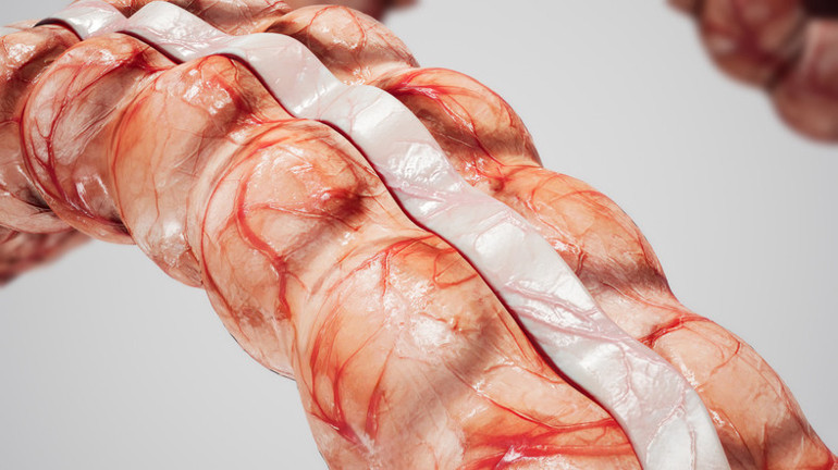 Bağırsaklarda baloncuk mu olur demeyin Oluyormuş ve bende 5 tanecik var