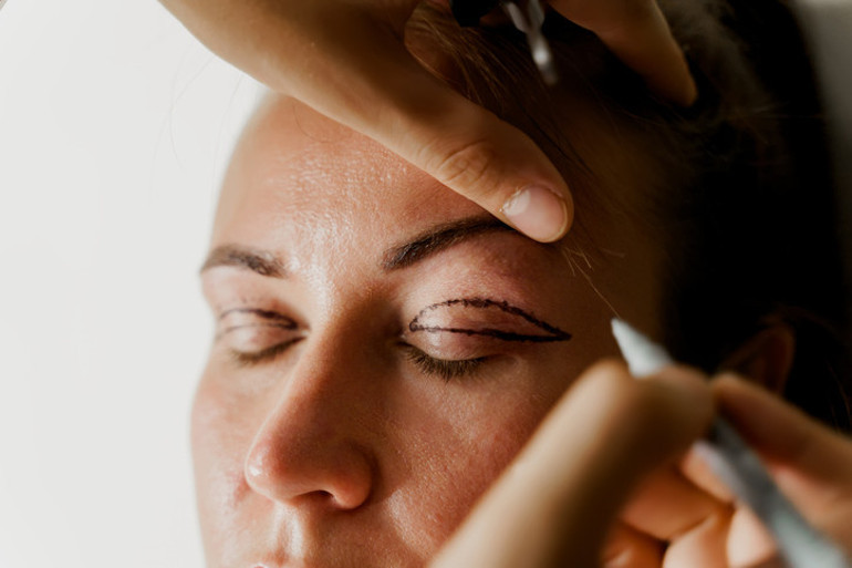 Basit bir operasyon diye girdi, şimdi bir gözünü tam kapatamıyor | 6 SORUDA GÖZ KAPAĞI ESTETİĞİ