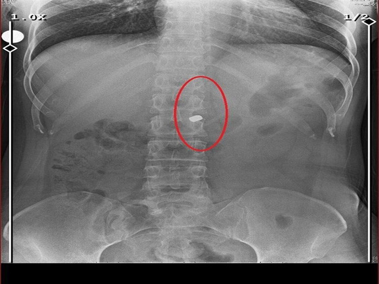 Arkadaşını öldürdükten sonra sevgilisini yaralı halde 21 gün evinde tutmuştu İstenen ceza belli oldu: Savunması pes dedirtti